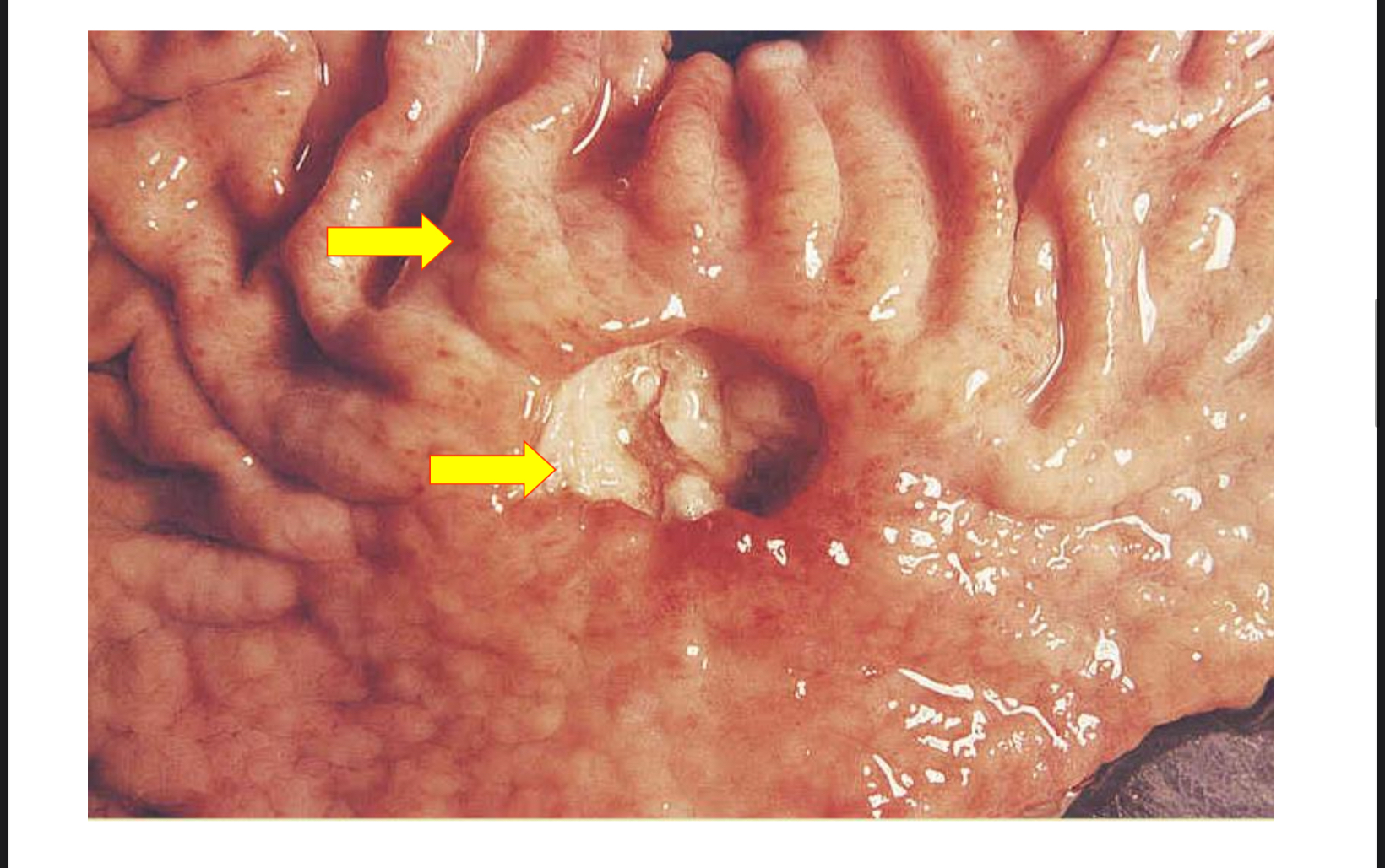 <p>Identify </p>