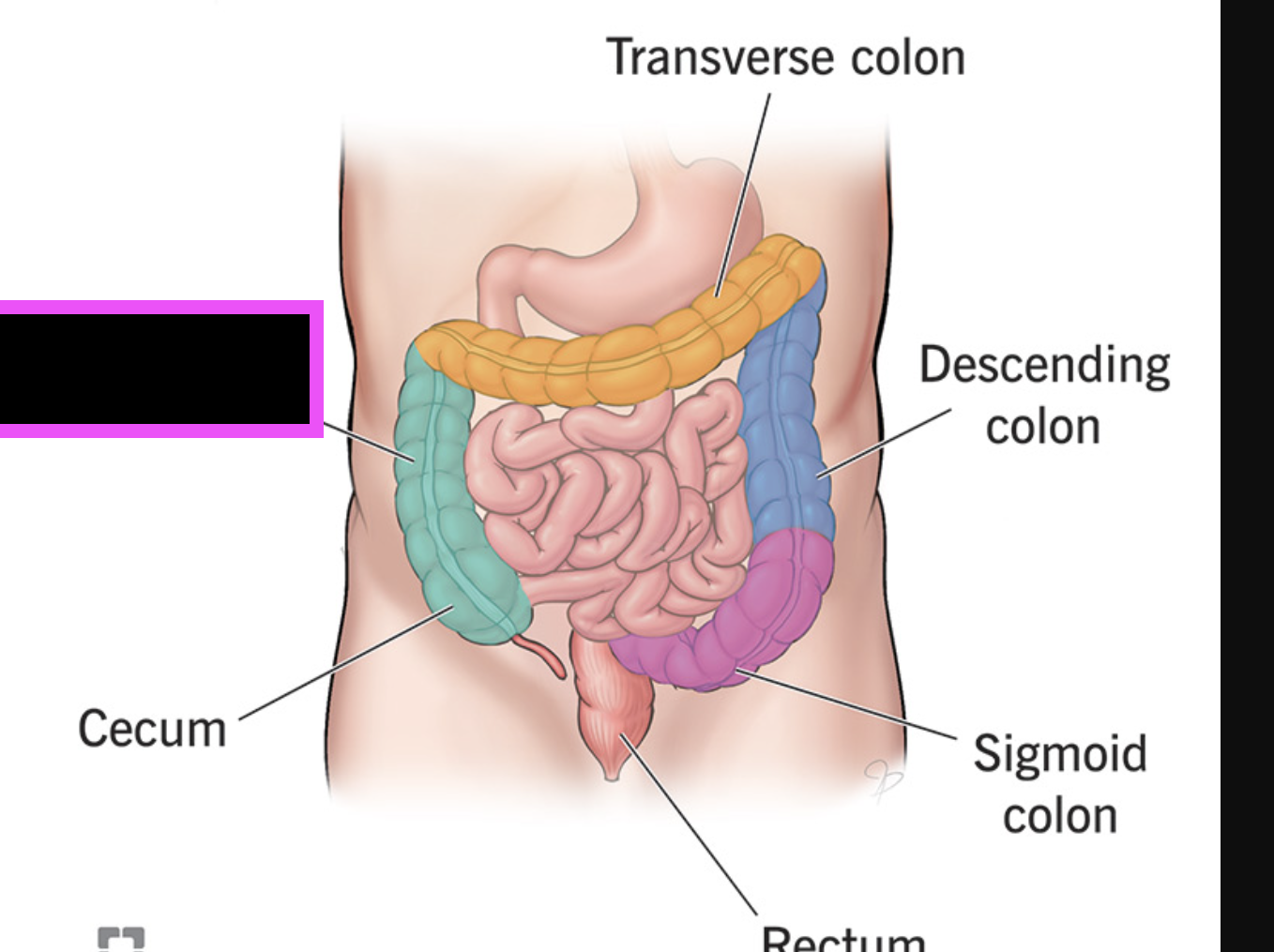 term image