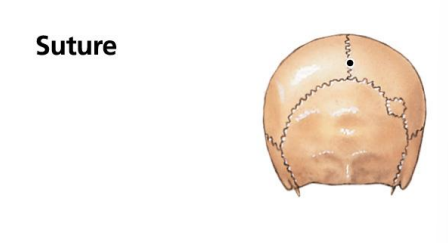 <p>Sutures? What is the functional classification of the joint?</p>