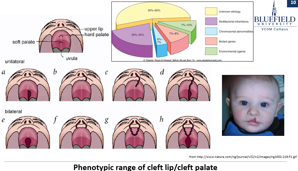 <p>It involves <strong>multiple genes</strong> and <strong>environmental factors</strong>. It explains <strong>variation in phenotypes</strong> such as <strong>cleft lip/palate</strong> and shows <strong>increased liability within families</strong>, though it does <strong>not follow a Mendelian pattern</strong>.</p>