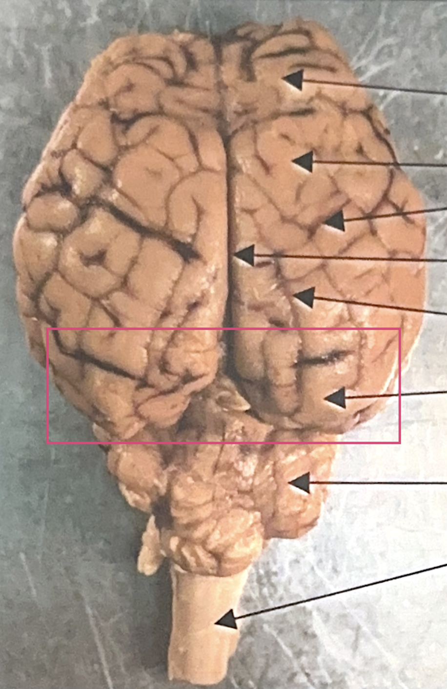 <p>What is this highlighted figure?</p>