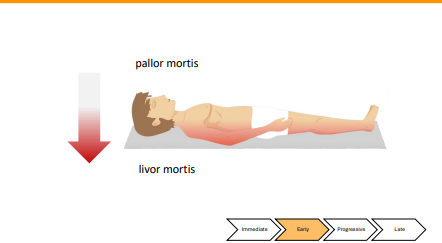 <p>What happens in Pallor Mortis&nbsp;</p>