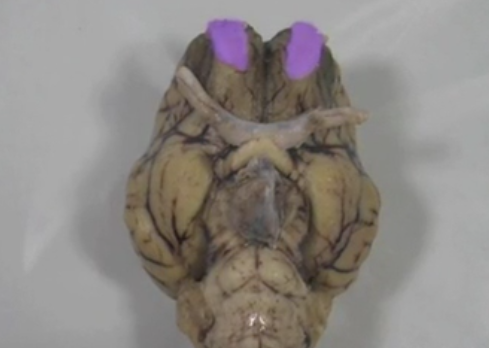 <p>Olfactory Bulb </p>