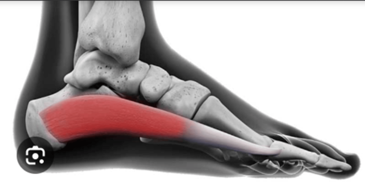 <p>what is this muscle?</p>