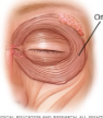 <p>What muscle is this? (eye in image)</p>