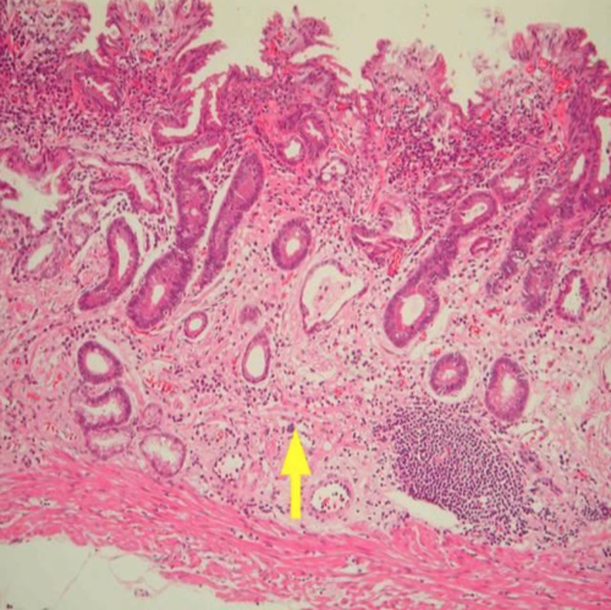 <p>Composed of cells that are specialized to produce and secrete substances</p><p>A gland consists of one or more cells that make and secrete a product. This product, called a secretion, is a water-based fluid that often contains protein</p>