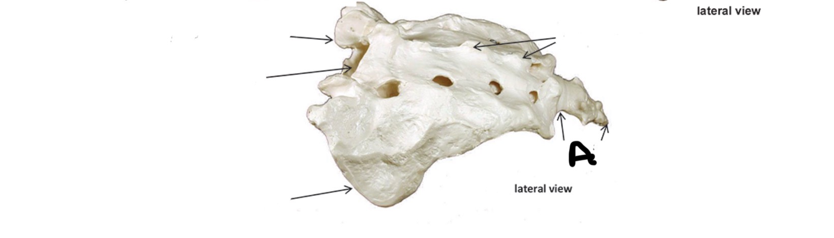 <p>What bone is this?</p><p>What is A?</p>