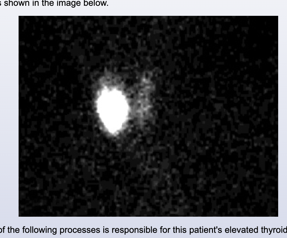 <p>Toxic Thyroid</p>
