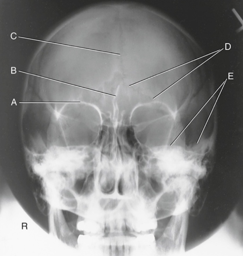 <p>E is:</p>