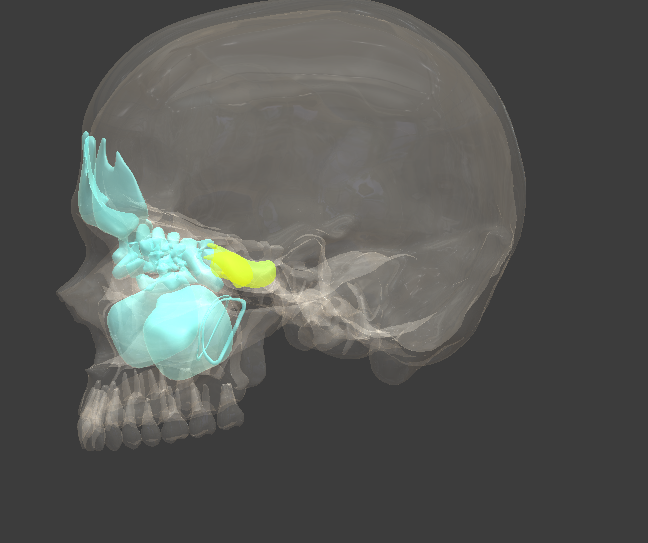 term image