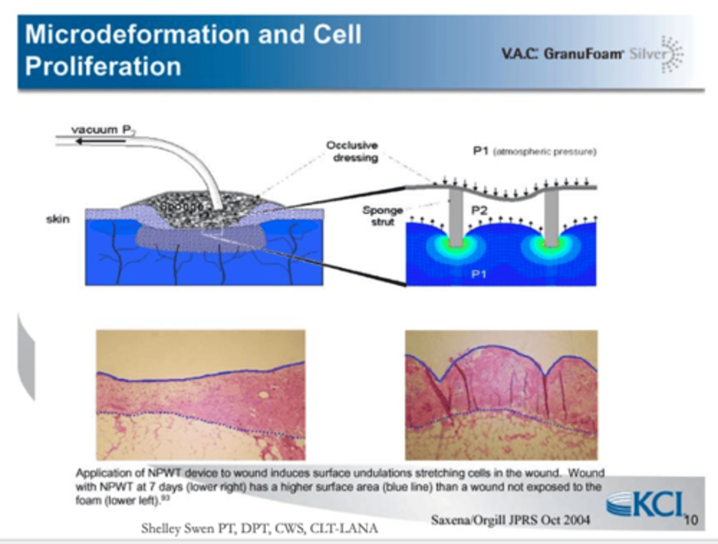 <p>When you increase cell proliferation, increase metabolic activity, increase fibroblast migration and increase granulation tissue growth</p>