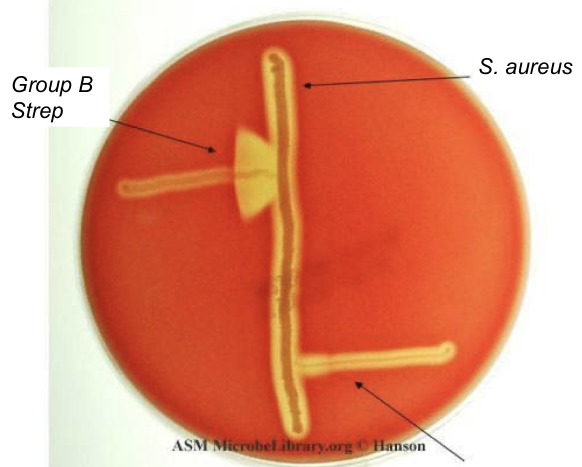 <p>Identification for <strong>Group B</strong> or <strong><em>S. agalactiae</em></strong></p>