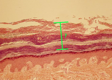 <p><span>Identify the indicated layer of thick skin.</span></p>