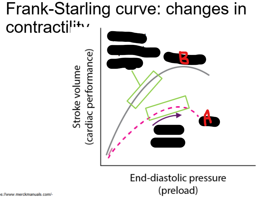 <p>A =  heart __ due to poor __load</p><p>B = __</p>