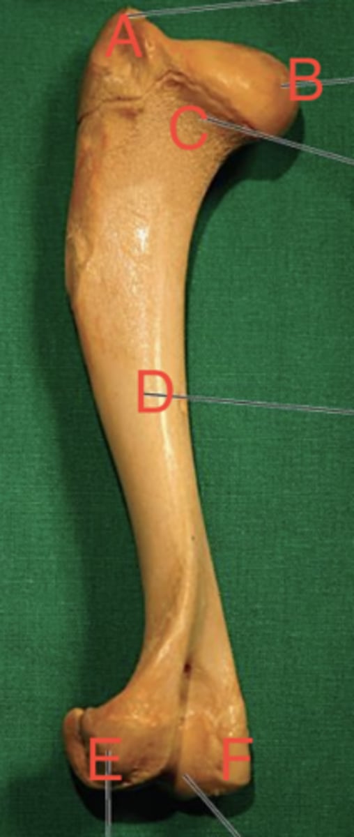 <p>What structure is labeled as E in this picture?</p>