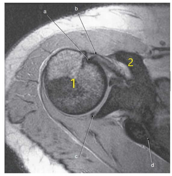 <p>What is letter d ?</p>