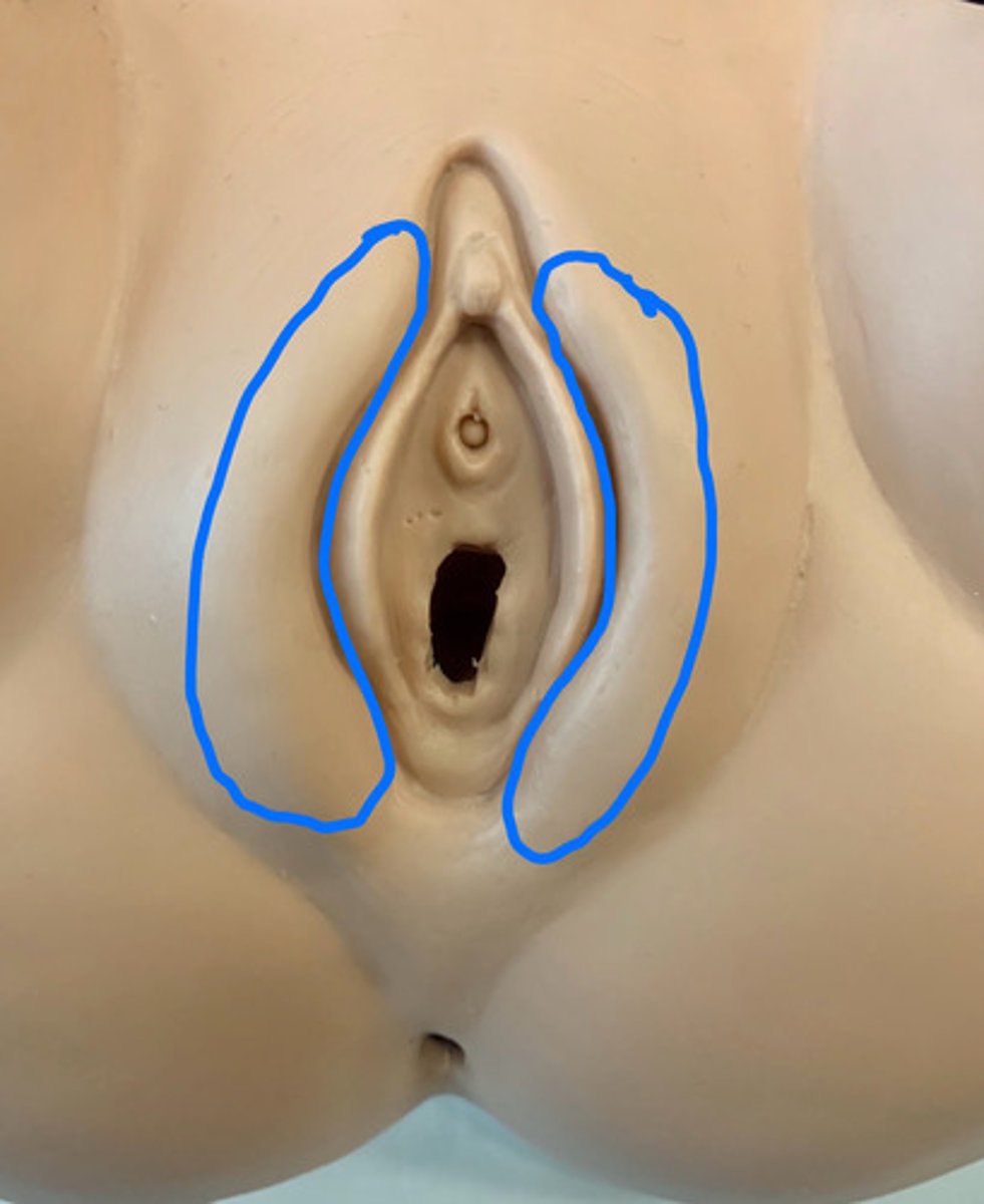 <p>ID Structure outlined in Blue</p>