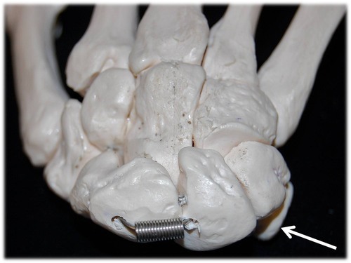 Name this specific bone of the hand (posterior view).