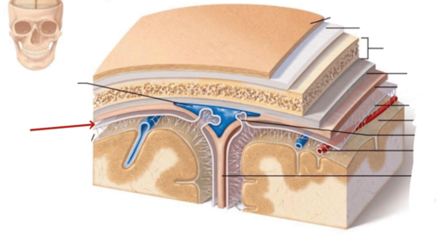 <p>Sub-dural Space</p>