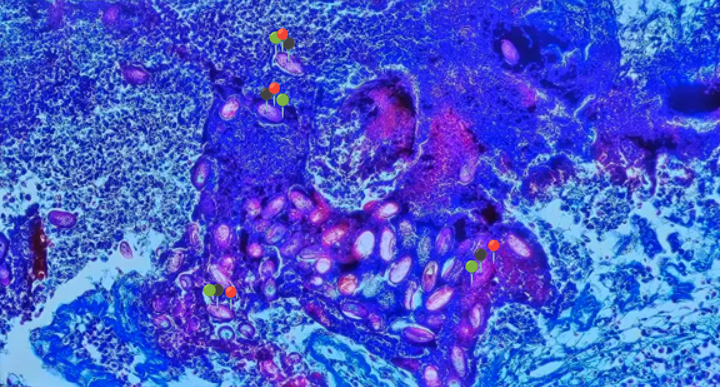 <p><strong><em>Eimeria stedae</em></strong></p><p>(Oocysta)</p><p></p><p></p><p><strong>Organelle:</strong></p><p></p><ul><li><p><span data-name="red_circle" data-type="emoji">🔴</span><span data-name="yellow_circle" data-type="emoji">🟡</span><span data-name="green_circle" data-type="emoji">🟢</span><span data-name="blue_circle" data-type="emoji">🔵</span><span data-name="purple_circle" data-type="emoji">🟣</span><span data-name="black_circle" data-type="emoji">⚫</span><span>️</span><span data-name="white_circle" data-type="emoji">⚪</span><span data-name="brown_circle" data-type="emoji">🟤</span></p></li></ul><p></p><ul><li><p><span data-name="red_circle" data-type="emoji">🔴</span><span data-name="yellow_circle" data-type="emoji">🟡</span><span data-name="green_circle" data-type="emoji">🟢</span><span data-name="blue_circle" data-type="emoji">🔵</span><span data-name="purple_circle" data-type="emoji">🟣</span><span data-name="black_circle" data-type="emoji">⚫</span><span>️</span><span data-name="white_circle" data-type="emoji">⚪</span><span data-name="brown_circle" data-type="emoji">🟤</span></p></li></ul><p></p>