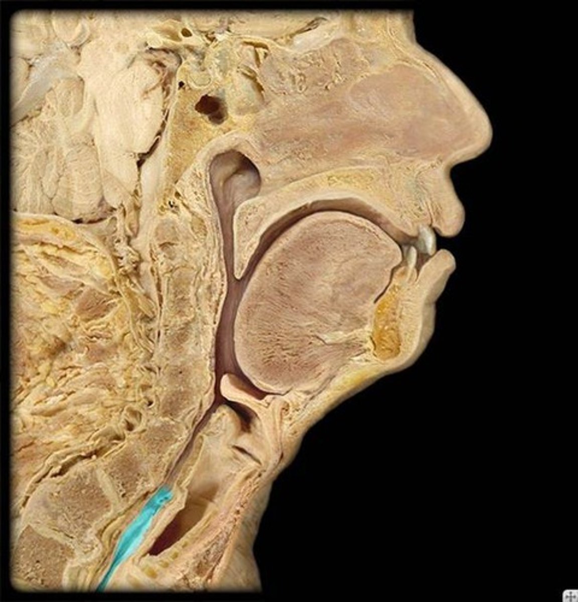 <p>Identify this passageway.</p>