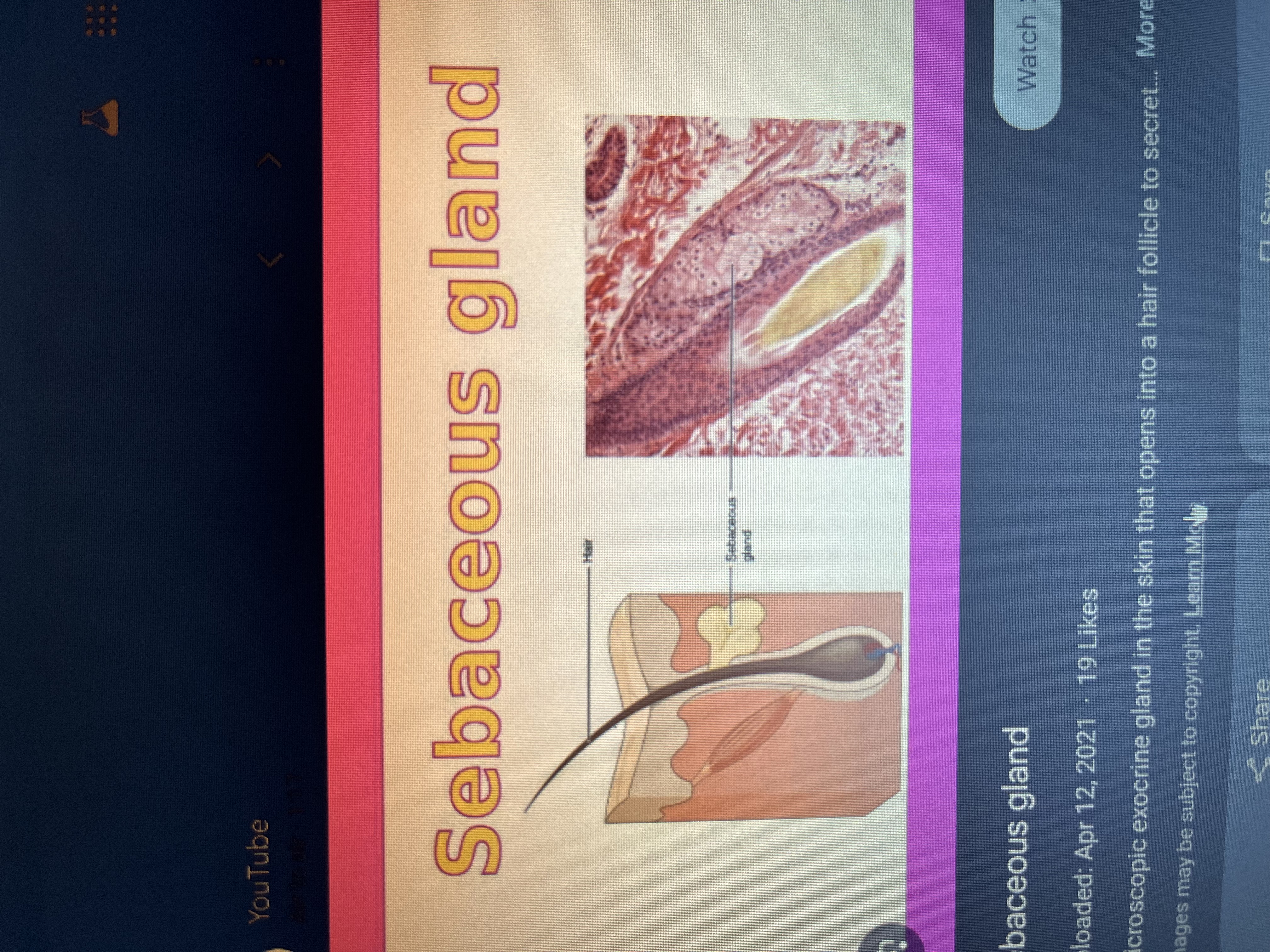 <p>Sebaceous gland</p>