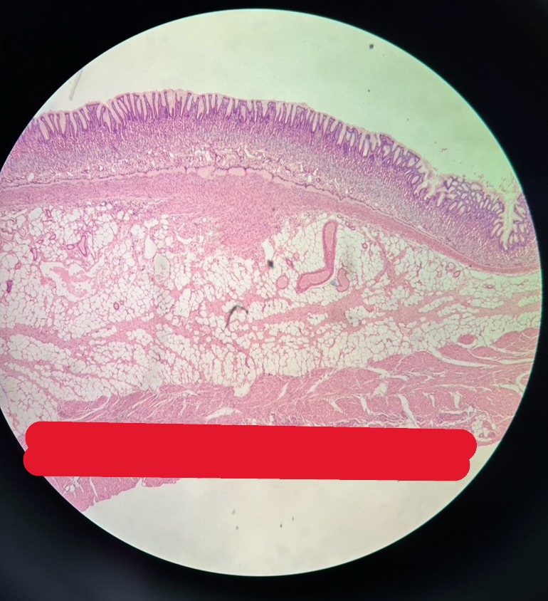 <p>Organ?</p><p>What is the name of the glands in mucosa layer?</p><p>Possibly transition from this organ to another may indicate what structure?</p>