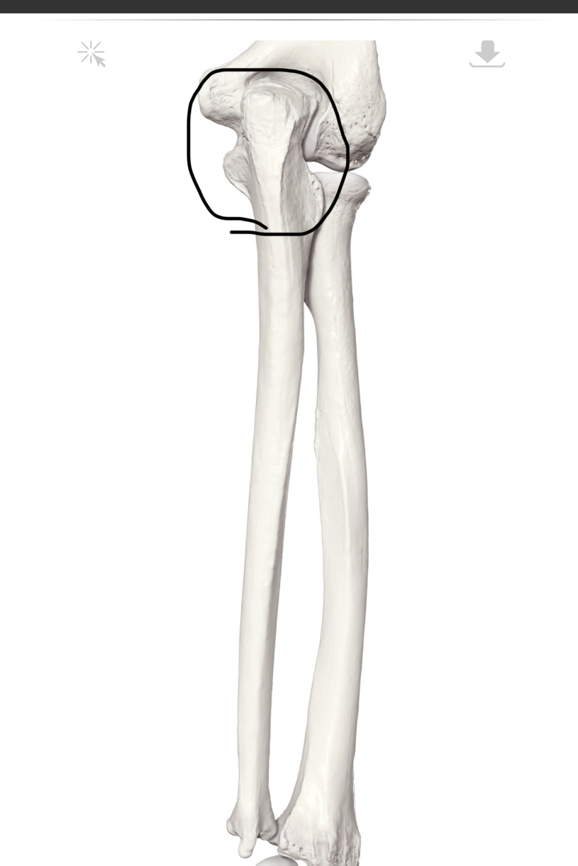 <p>Hoe heet dit deel?</p>