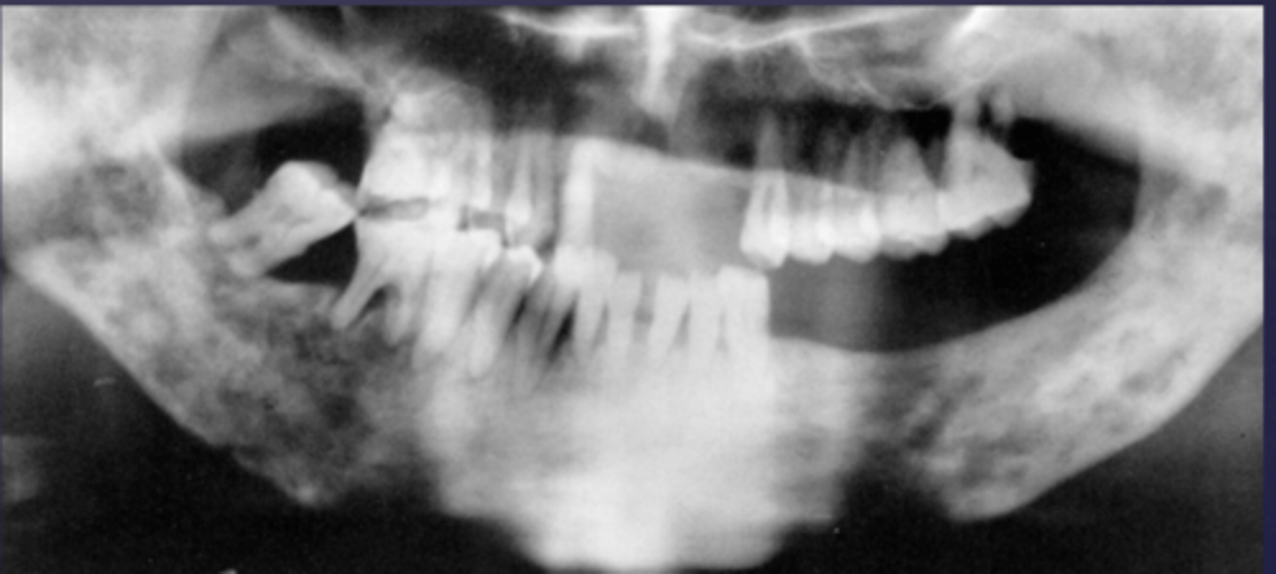<p>What category would this lesion be part of?</p>