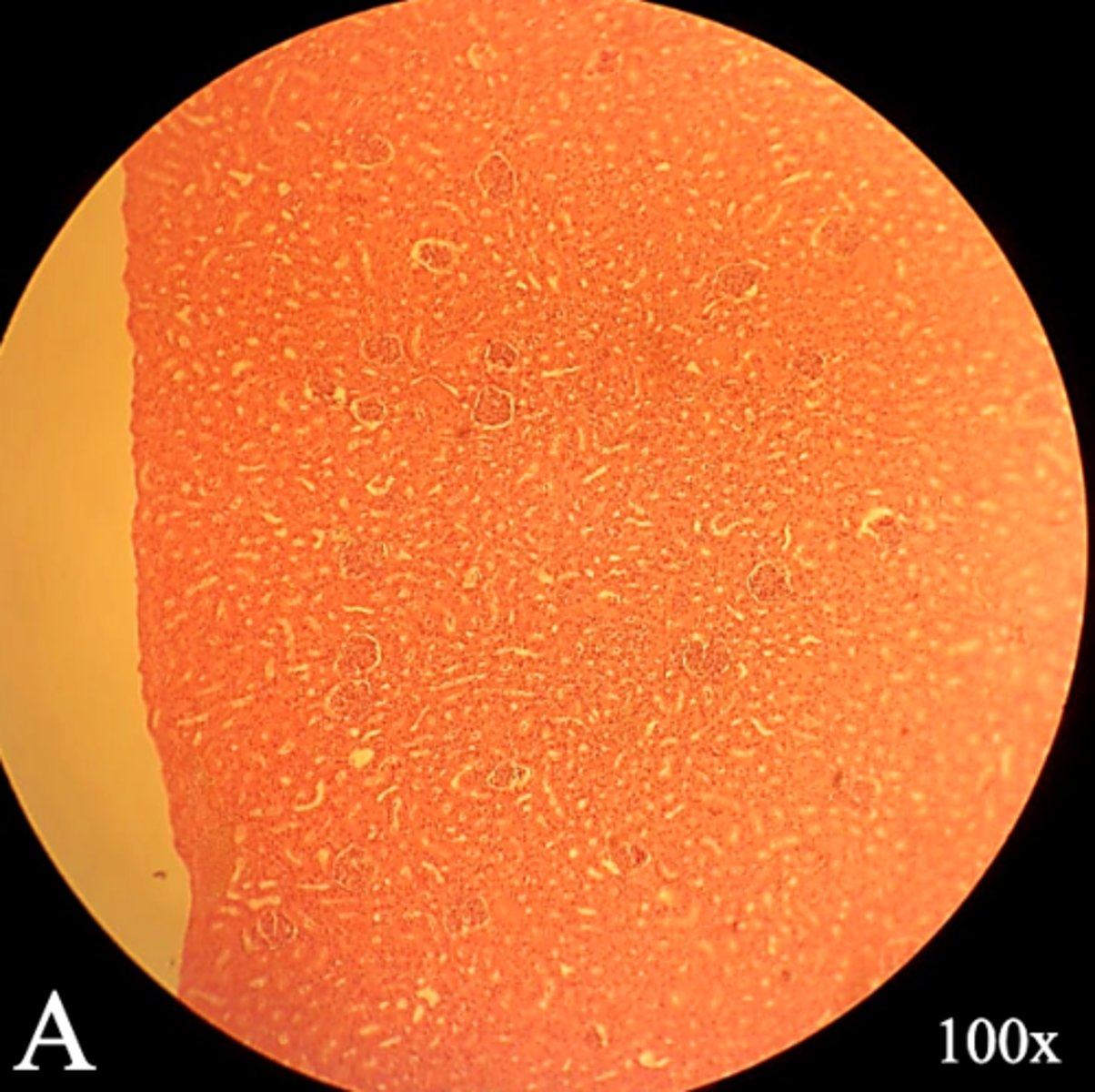 <p>Name this region of the kidney</p>