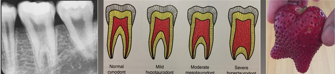 <ul><li><p>Enlargement of the body and pulp chamber</p></li><li><p>Most common mandibular molars and premolars</p></li><li><p>No treatment</p></li><li><p>Associated with many syndromes</p></li></ul><p></p>