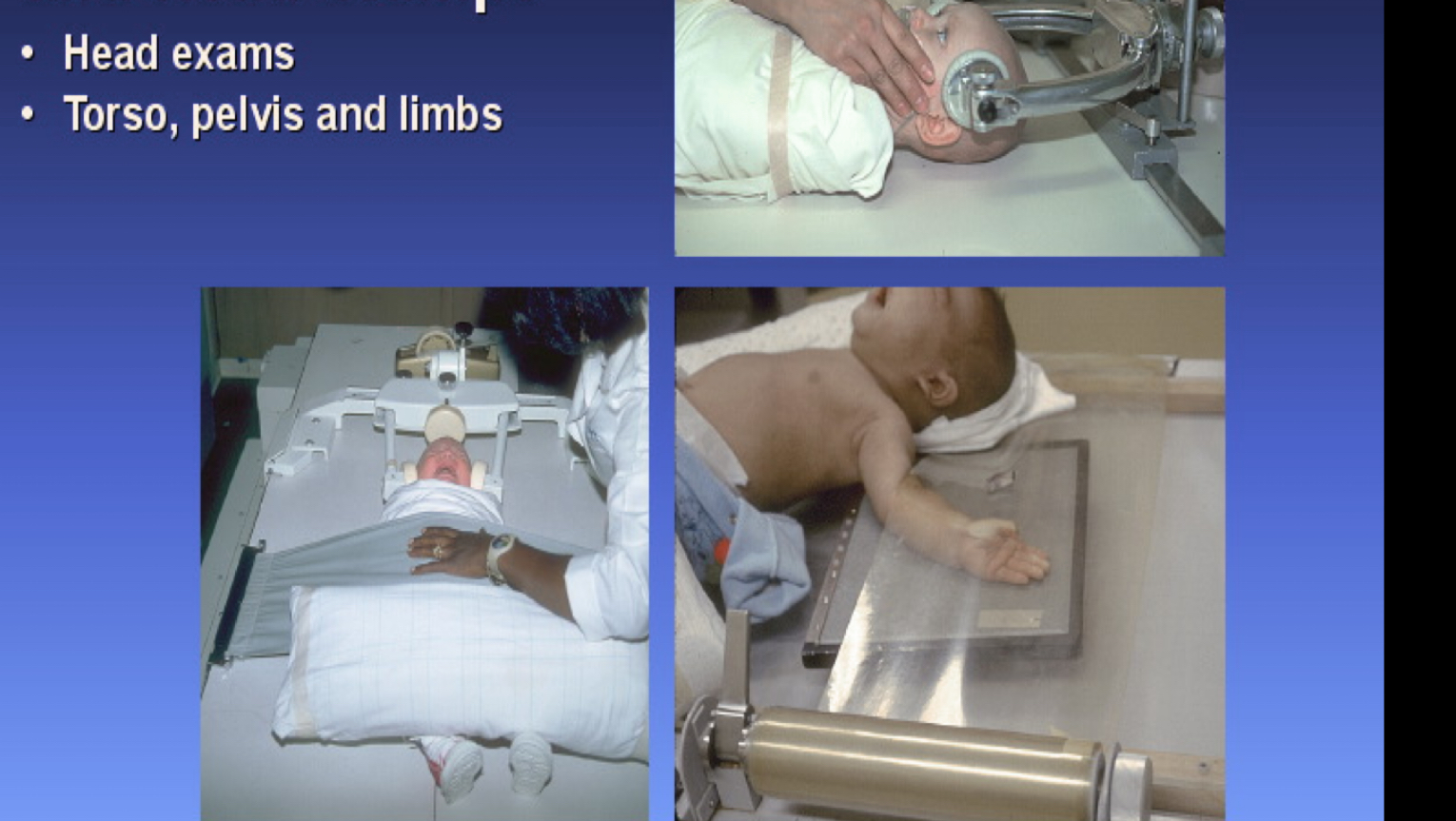 <p>What type of immobilization device is this?</p>