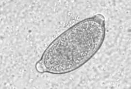 <p><span><span>Eucoleus aerophilus</span></span></p>