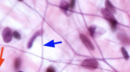 <p>Elastic fiber</p>