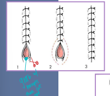 <p><span>Abnormal Wound type closures</span></p>