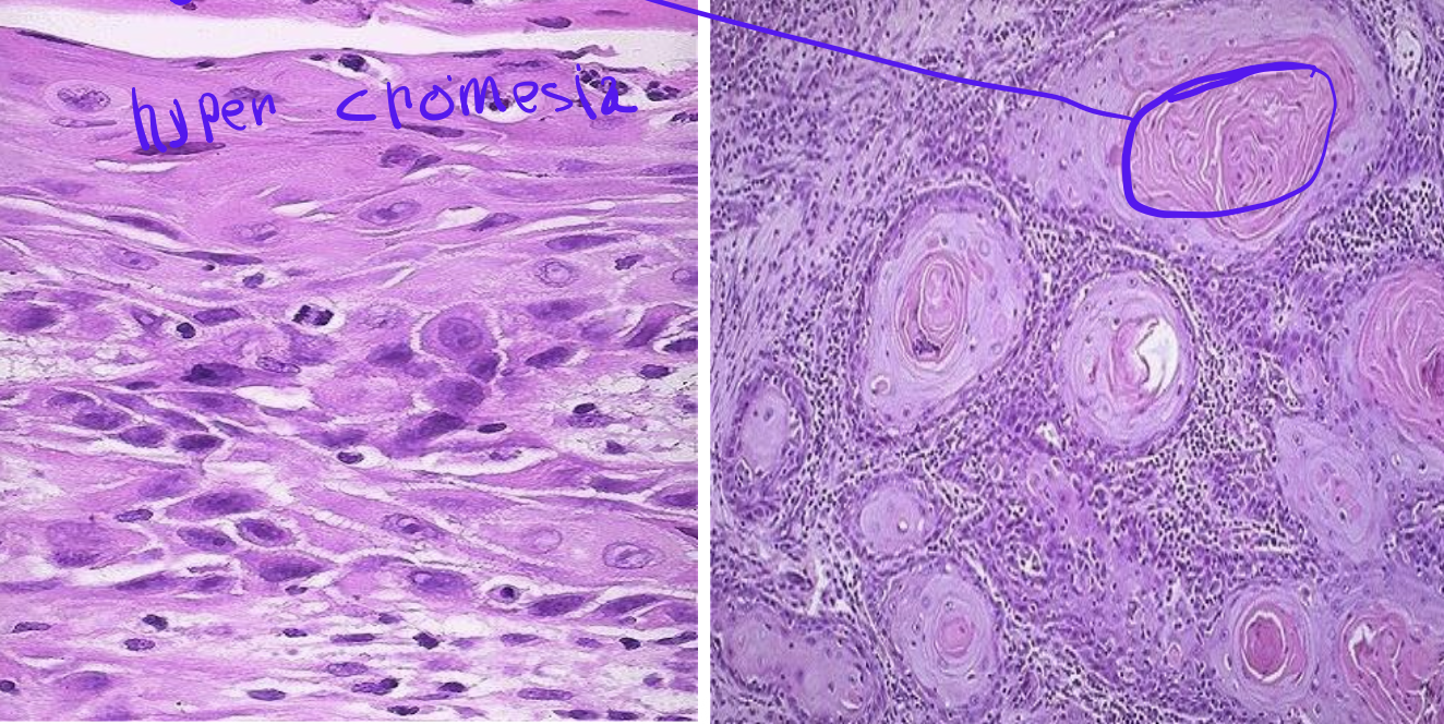<p>Identify the <strong>organ</strong> and the <strong>diagnosis</strong> in this format: <em>diagnosis, organ</em></p>