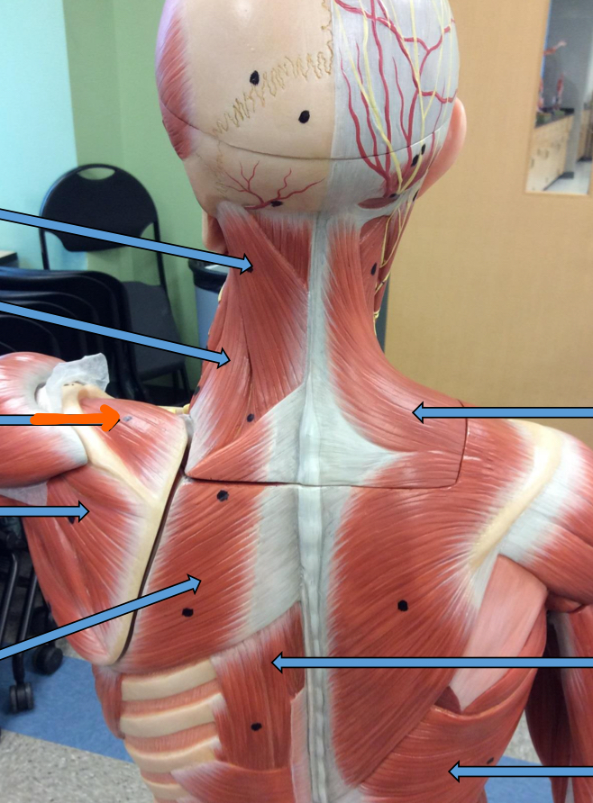 <p>Identify this muscle?</p>