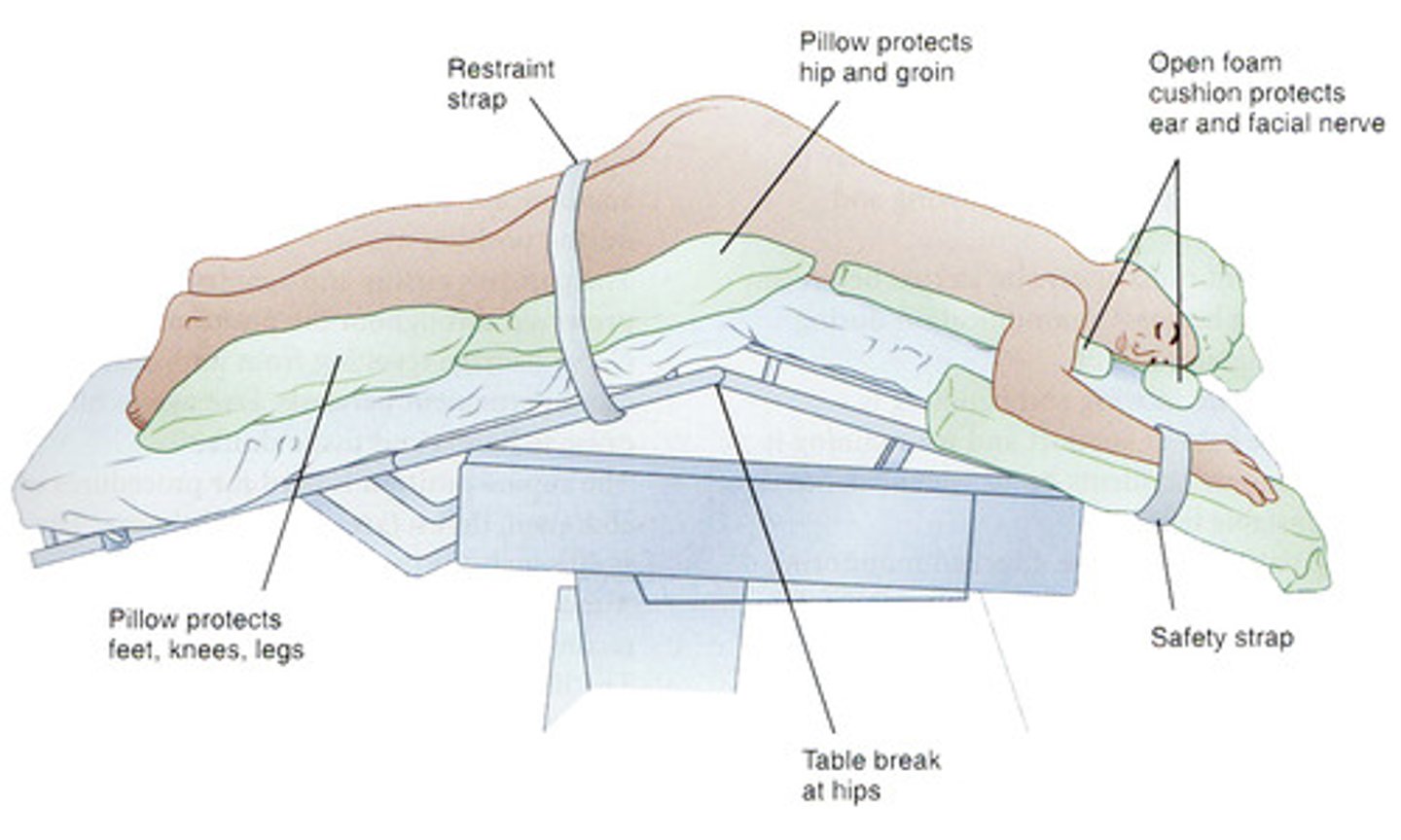 <p>jackknife→ used in colorectal sx</p>
