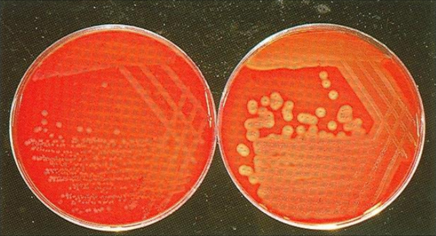 <ol><li><p>SN (L)</p></li><li><p>SN (R)</p></li><li><p>Which is more hemolytic? L or R</p></li></ol><p></p>