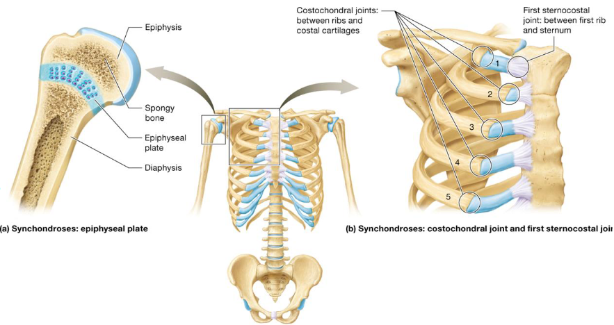 <ul><li><p>Type of cartilaginous joint</p></li><li><p>Bones joined together by hyaline cartilage</p></li><li><p>Immovable joint (synarthrosis)</p></li><li><p>Ex</p><ul><li><p>Epiphyseal plates</p></li><li><p>First sternocostal &amp; all costochondral joints</p></li></ul></li></ul><p></p>