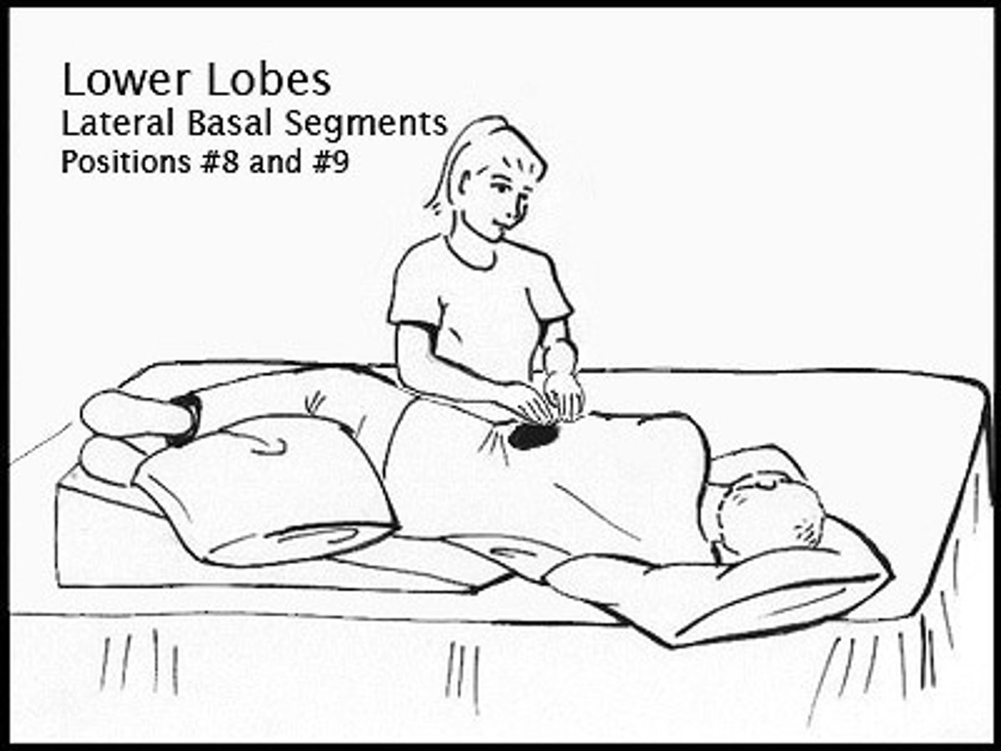 <p>*Patient position*: table elevated 20''. Patient lays down on abdomen, head down, and rotates 1/4 turn upward. Upper leg flexed over pillow for support.</p><p>*PT*: percussion over uppermost portion of lower ribs.</p>