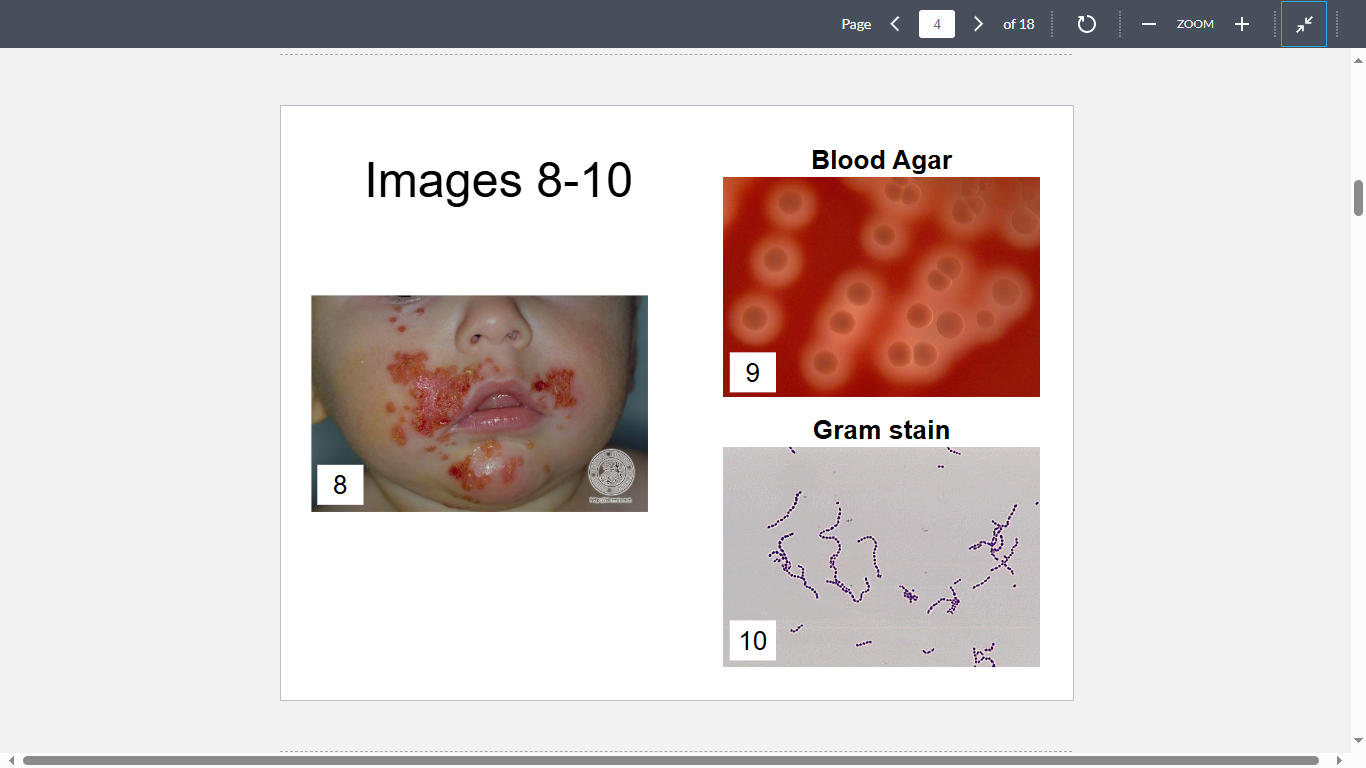 <p>A 2-year-old boy presents with skin lesions shown in Image 8. Specimens obtained from the lesions yielded this isolate (Images 9&10)</p><p></p><p>What is the most likely cause?</p>