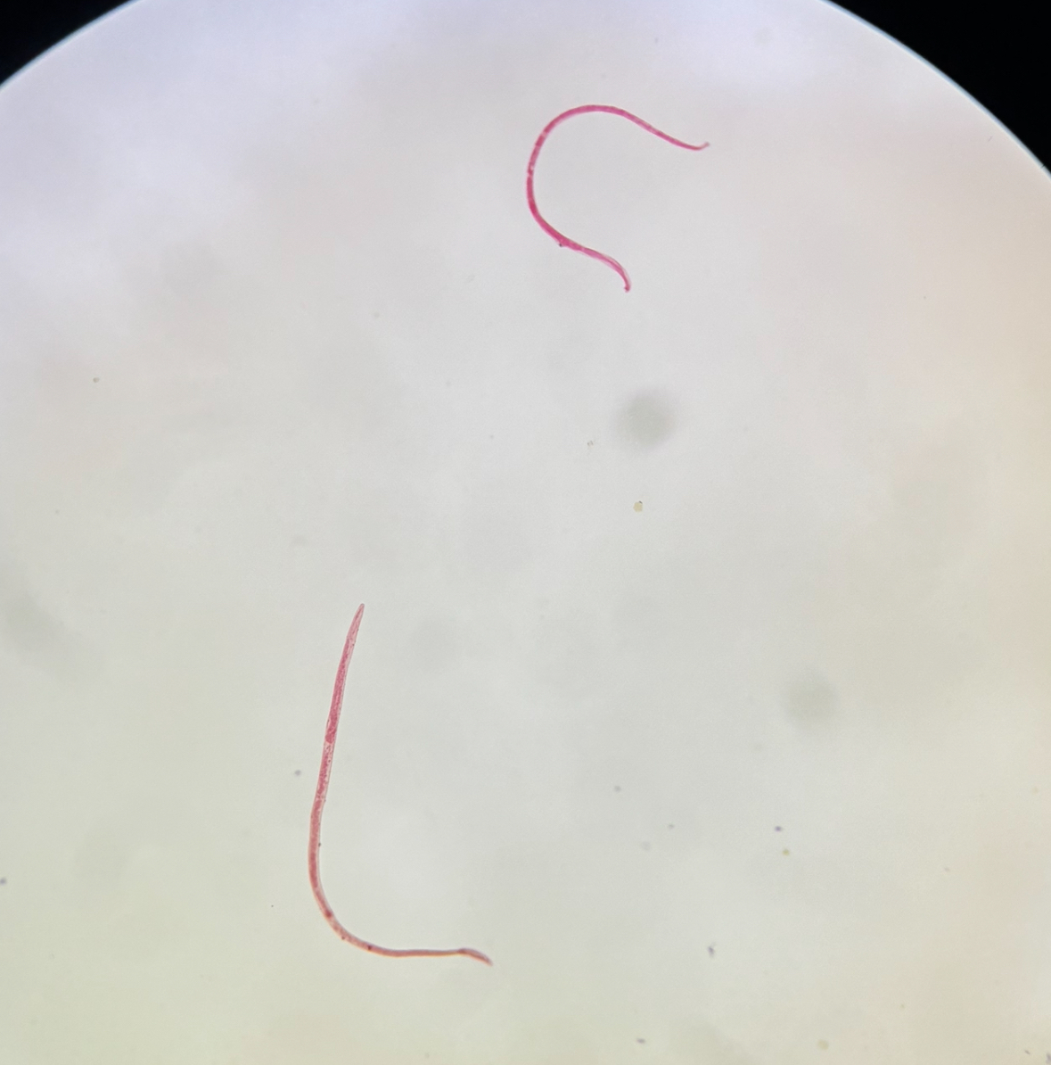 <p>Clase Adenophorea</p>