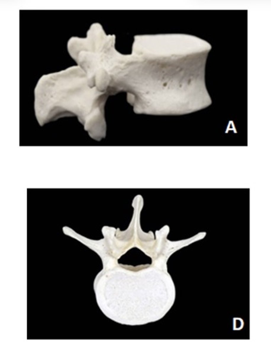 <p>ID the vertebra and view</p>