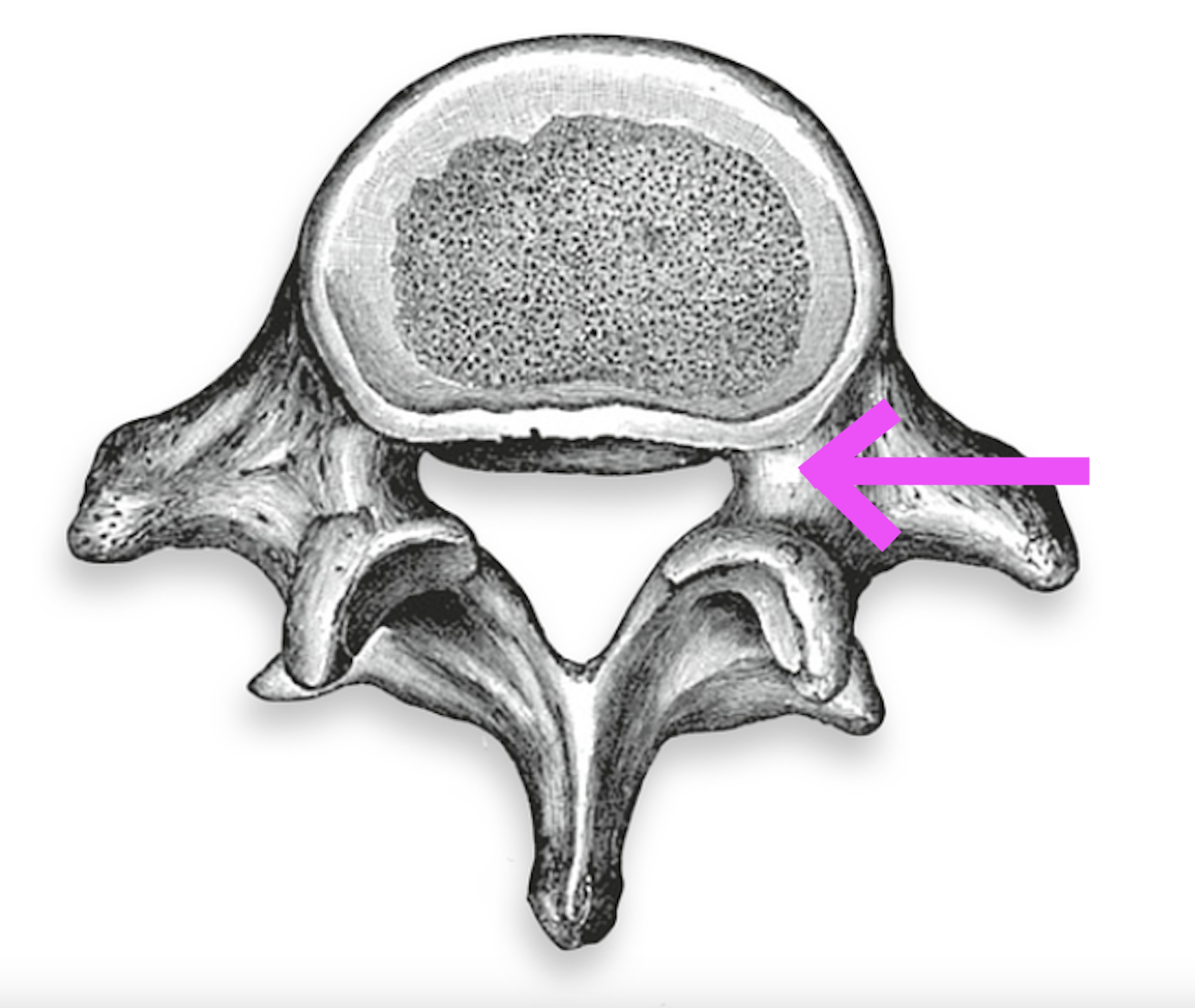 <p>What part of the vertebrae is this?</p>