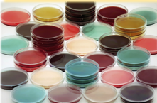 <p>Bacteria culture - Solid (jelly) nutrient solutions </p>