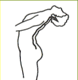 <p>What Movement is occurring?</p>