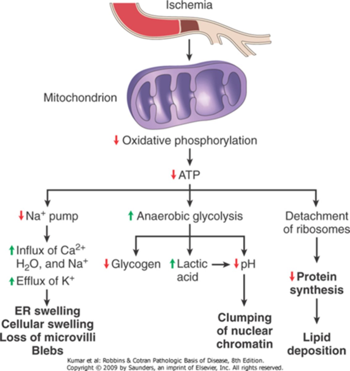 <p>Functional and morphologic consequences of decreased intracellular ATP during cell injury.</p><p>The morphologic changes shown here are indicative of reversible cell injury. Further depletion of ATP results in cell death, typically by necrosis. ER, endoplasmic reticulum.</p>