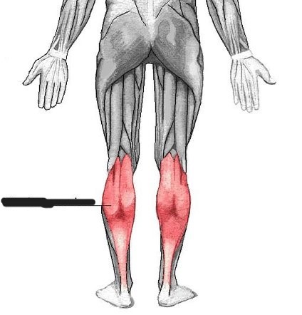 Identify what muscle this is 