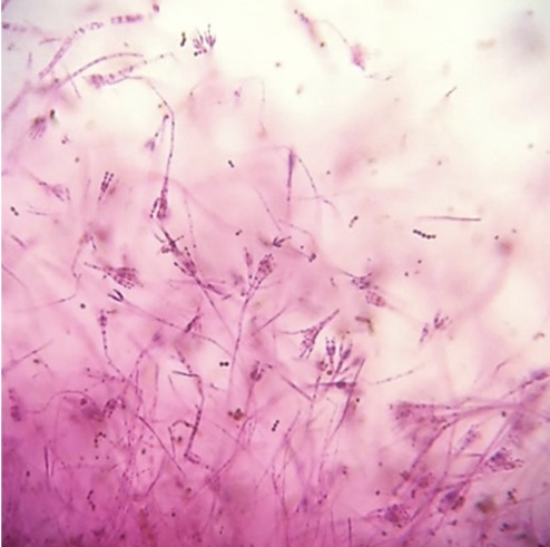 <p>Identify: Fungi</p>